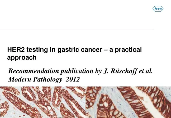 her2 testing in gastric cancer a practical approach