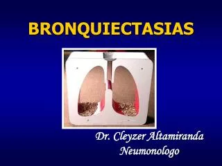 bronquiectasias