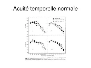 acuit temporelle normale