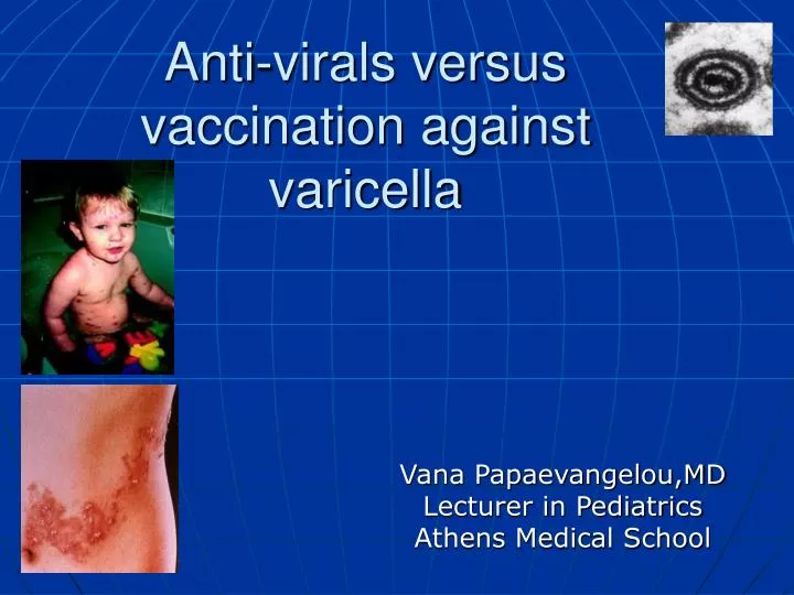 anti virals versus vaccination against varicella