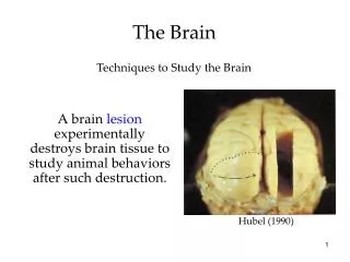 The Brain