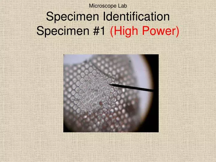 microscope lab specimen identification specimen 1 high power
