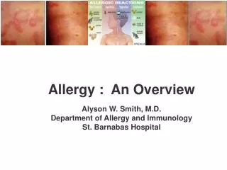 Allergy : An Overview Alyson W. Smith, M.D. Department of Allergy and Immunology