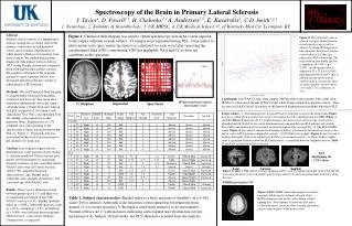 Spectroscopy of the Brain in Primary Lateral Sclerosis