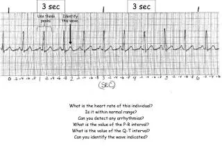 What is the heart rate of this individual? Is it within normal range?