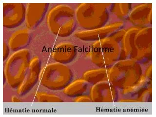 an mie falciforme