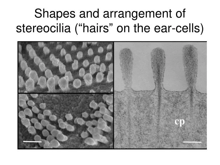 shapes and arrangement of stereocilia hairs on the ear cells