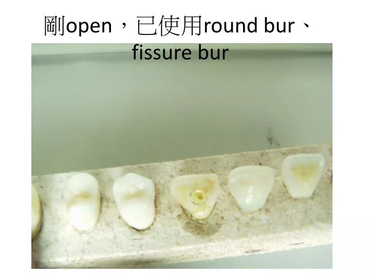 open round bur fissure bur