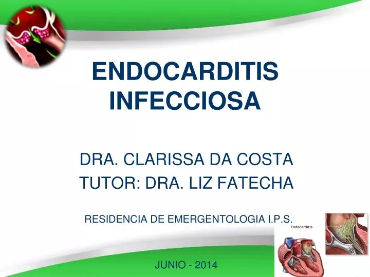 endocarditis infecciosa