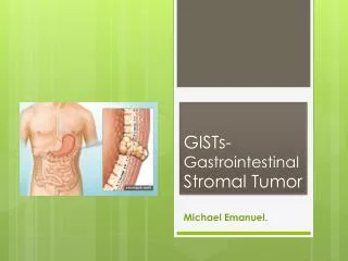 GISTs- Gastrointestinal Stromal Tumor