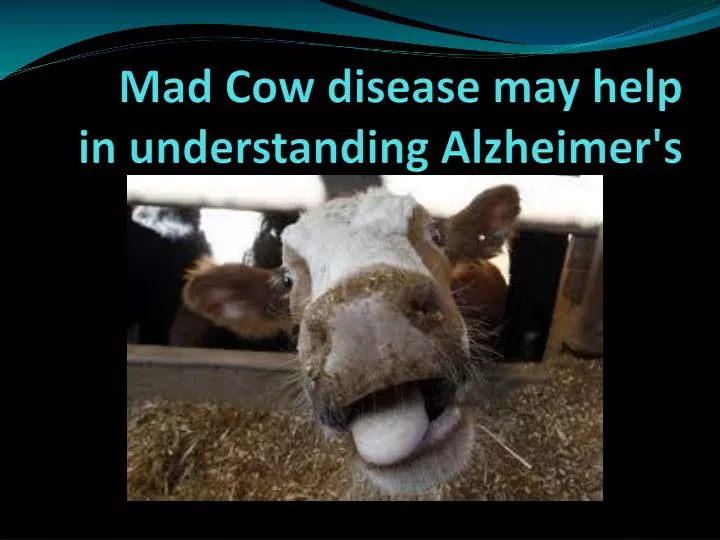 mad cow disease may help in understanding alzheimer s
