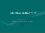 Electrocardiogram - slide 1