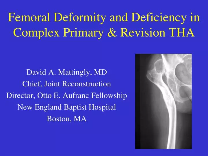 femoral deformity and deficiency in complex primary revision tha