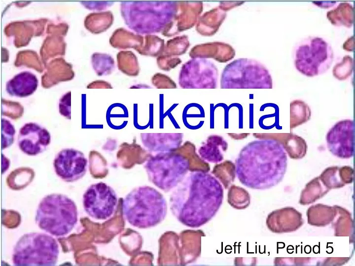 leukemia