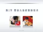 第二节 婴 幼 儿 急 症 救 助 技 术 - slide 1