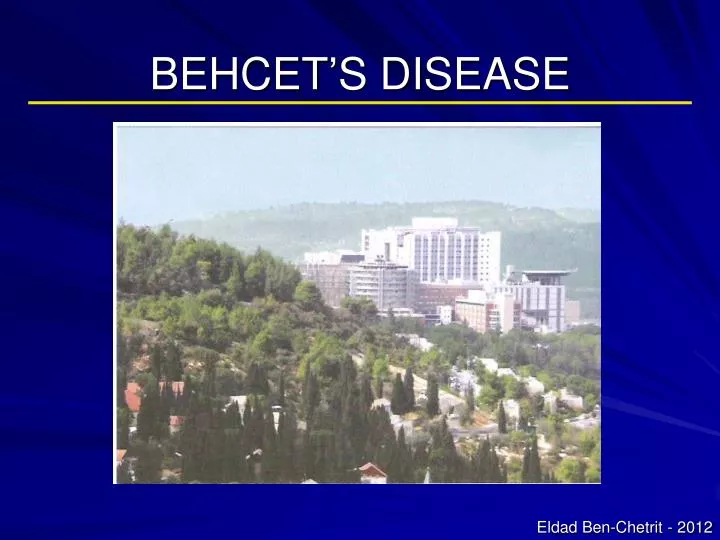 behcet s disease