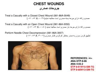 chest wounds