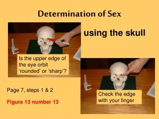 Determination of Sex