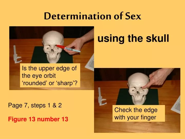 determination of sex