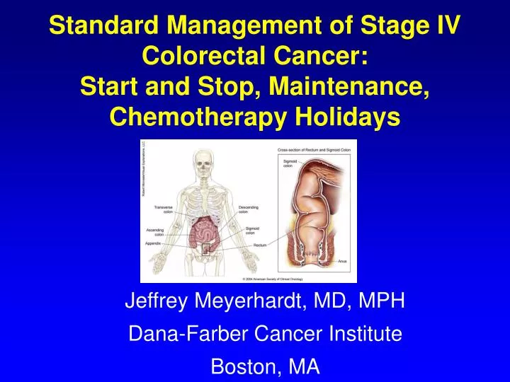 standard management of stage iv colorectal cancer start and stop maintenance chemotherapy holidays