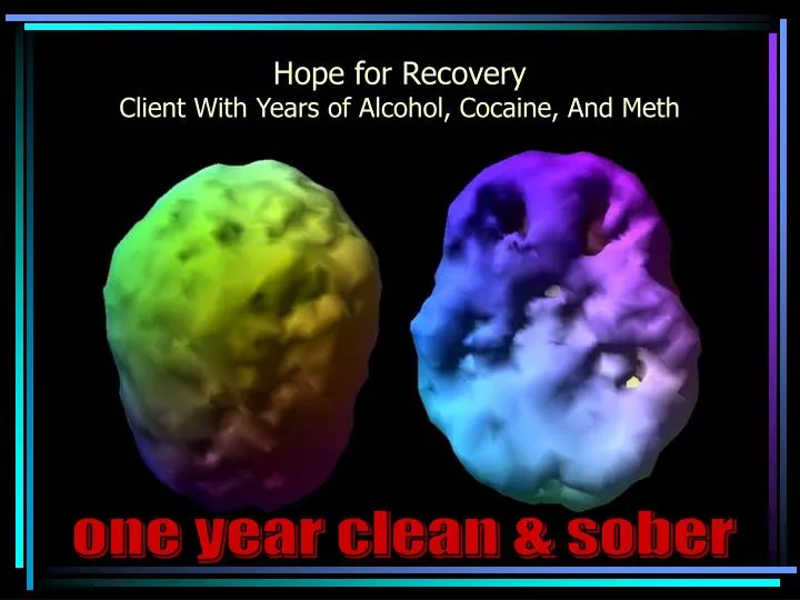 hope for recovery client with years of alcohol cocaine and meth