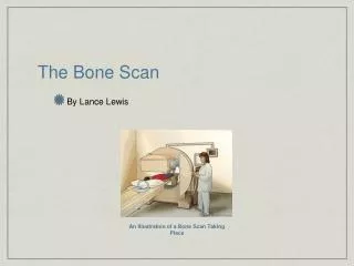 The Bone Scan