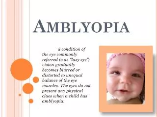 Amblyopia