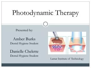 Photodynamic Therapy