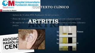 artritis