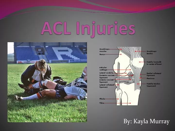 acl injuries