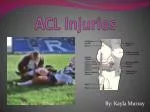 ACL Injuries - slide 1