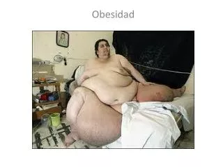 obesidad