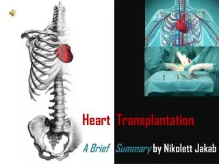 Heart Transplantation A Brief Summary by Nikolett Jakab
