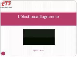 l lectrocardiogramme