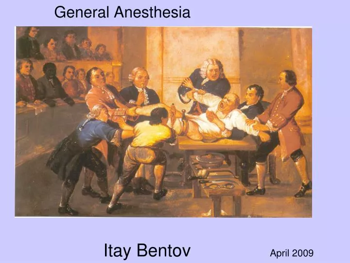 general anesthesia
