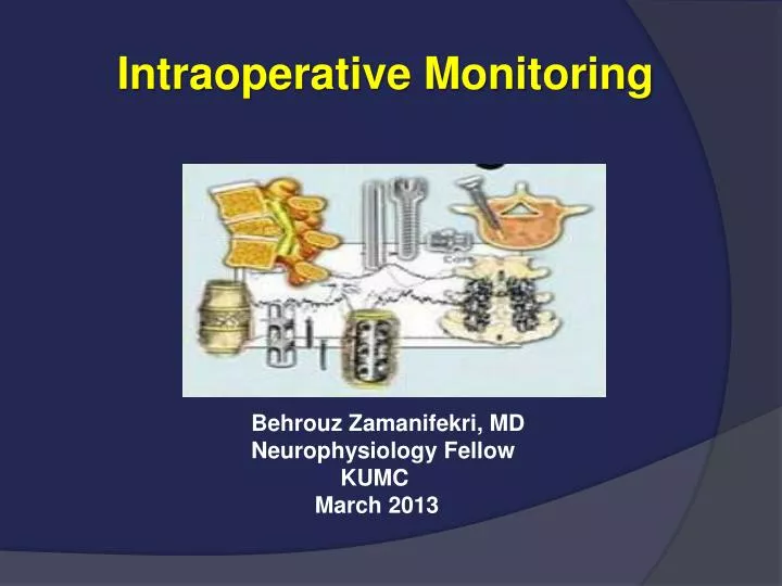 intraoperative monitoring