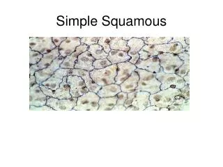 Simple Squamous