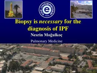 Biopsy is necessary for the diagnosis of IPF