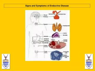 Signs and Symptoms of Endocrine Disease