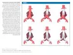 Advancements in Abdominal Aortic Aneurysm Treatment - slide 1