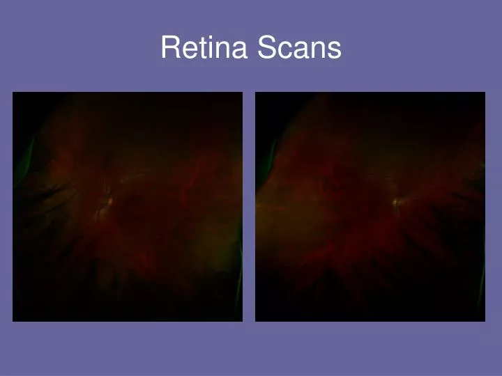 retina scans