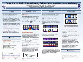 Detection of A2-P2 Interval using S-Transform and Gaussian Modeling