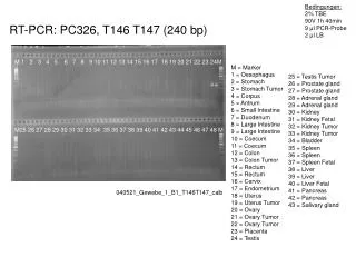 RT-PCR: PC326, T146 T147 (240 bp)