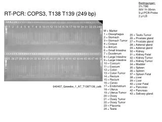 RT-PCR: COPS3 , T138 T139 (249 bp)