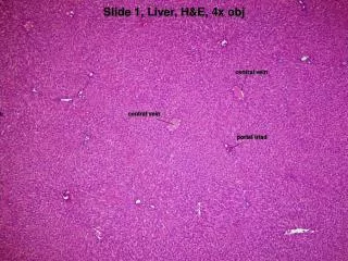 Slide 1, Liver, H&amp;E, 4x obj