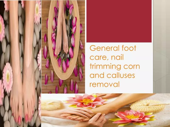 general foot care nail trimming corn and calluses removal