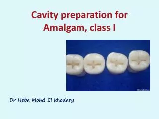 Cavity preparation for Amalgam, class I