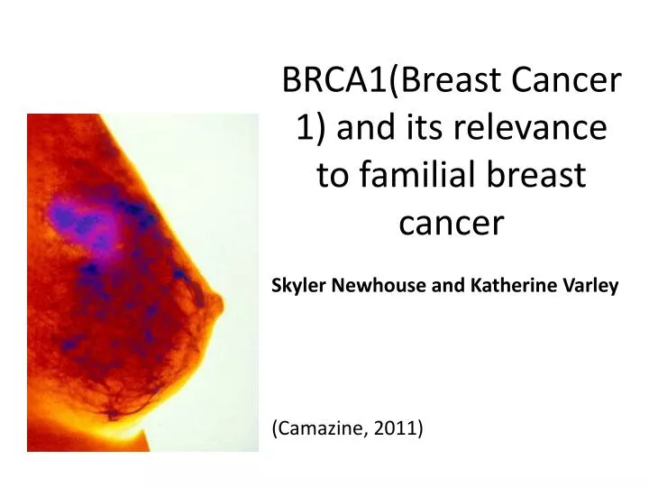 brca1 breast cancer 1 and its relevance to familial breast cancer