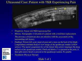 Ultrasound Case: Patient with TKR Experiencing Pain