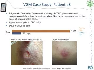 VGM Case Study: Patient #8